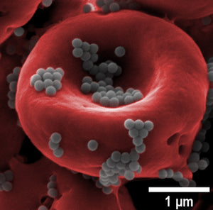 Nanotechnology a Drug Delivery System that Kills